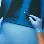 Xray