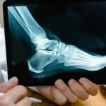 Person Holding Black Tablet Computer with Xray