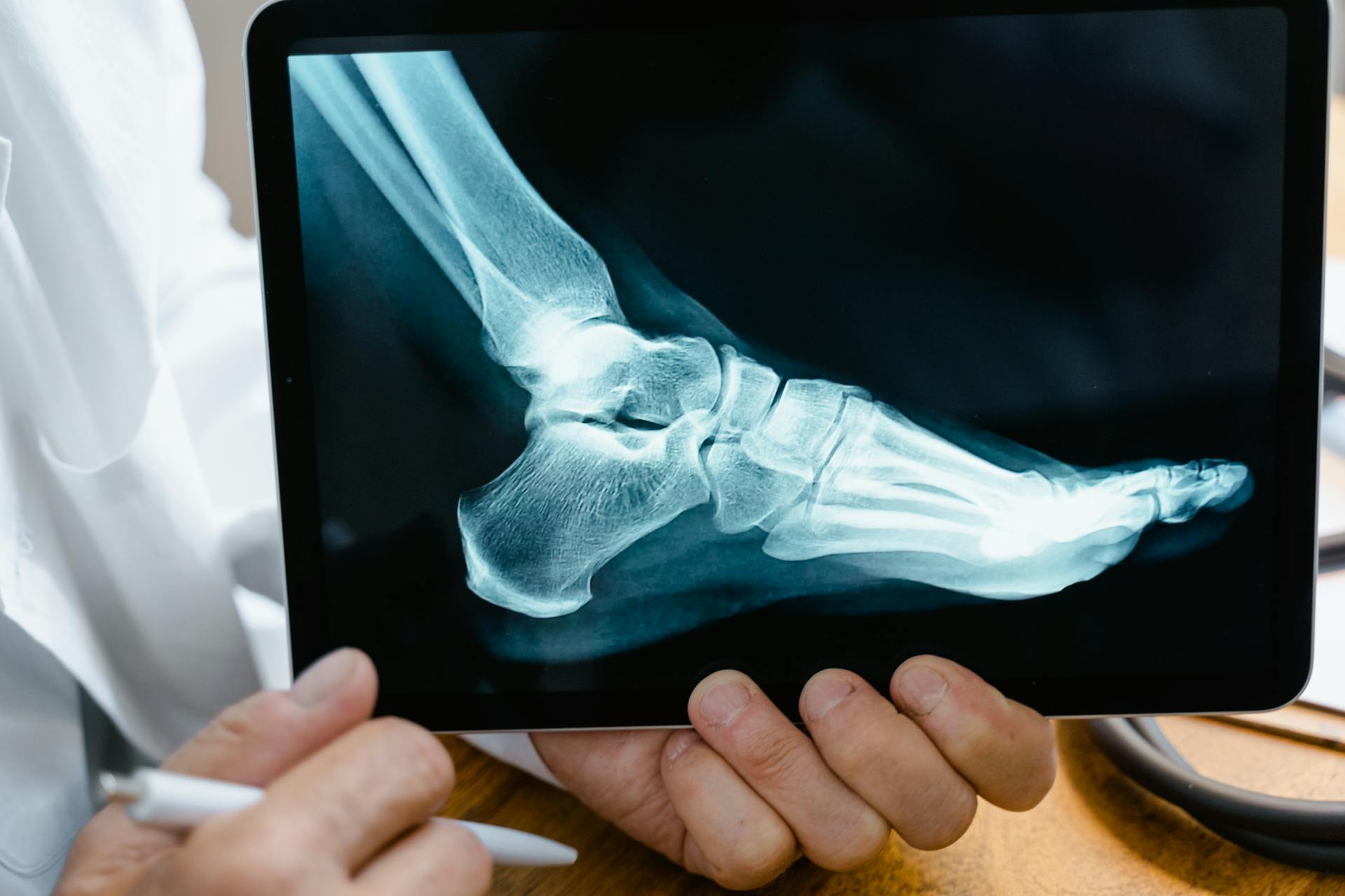 Person Holding Black Tablet Computer with Xray