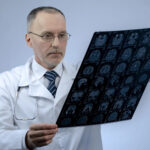 Why Do You Need A TBI Lawyer? 9 Professional neurosurgeon checking MRI brain image