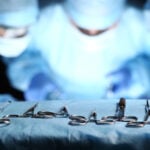 Surgical tools lying on table
